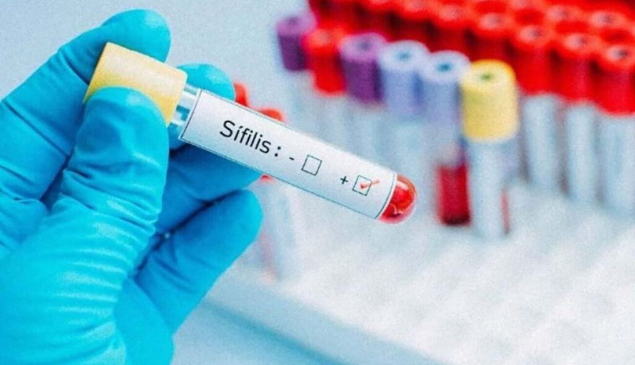 sifilis